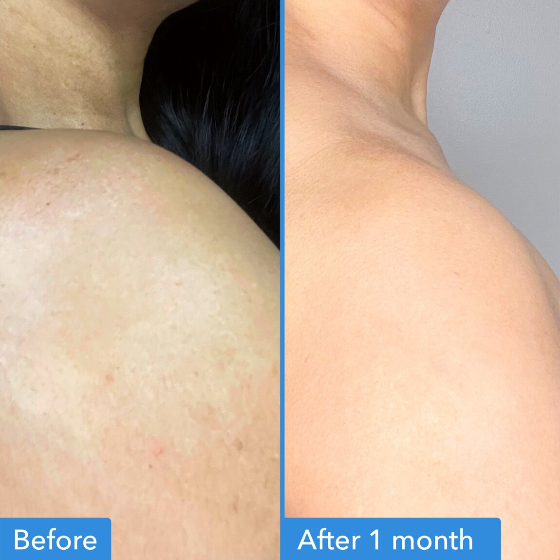 discoloration-correcting-body-treatment-k5 zb_p.jpg