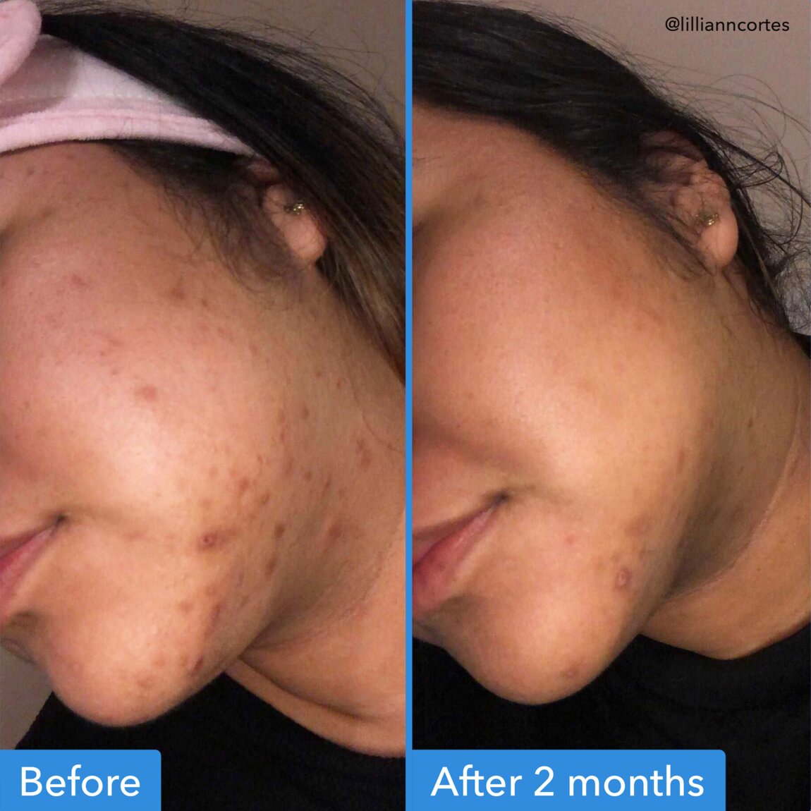 discoloration-correcting-serum-d7 zb_p.jpg