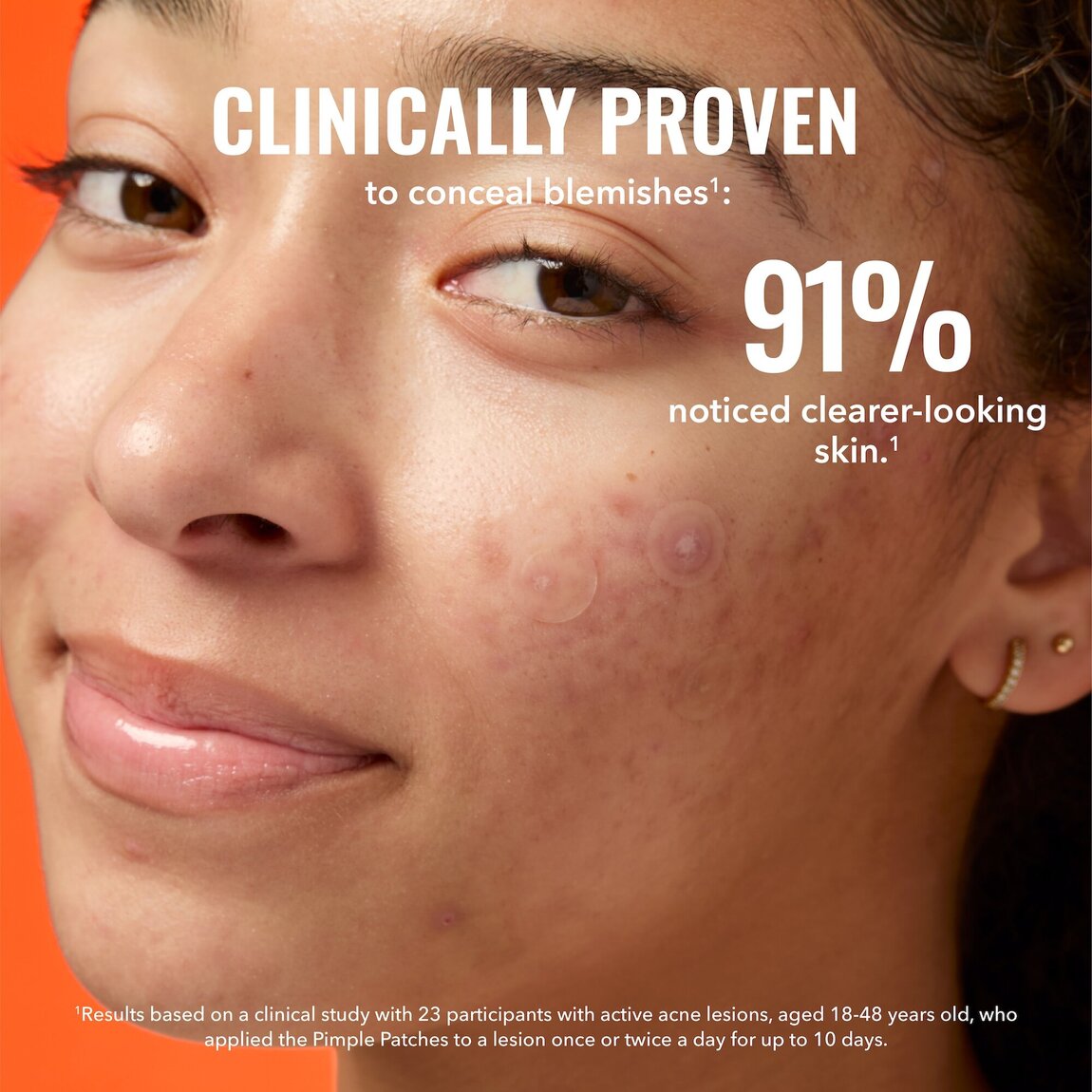 pimple-patches-c3 zb_p.jpg